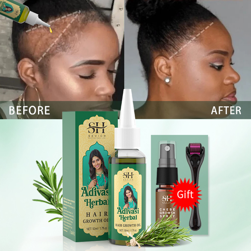 زيت نمو الشعر الأيورفيدي الهند - مراجعة Biotin Hair Growth وسعره